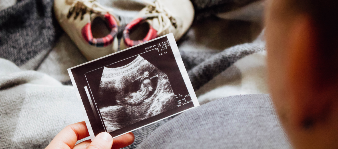 Zwangere vrouw kijkt naar de echografie van haar kind. Voor haar staan de eerste babyschoentjes al klaar.