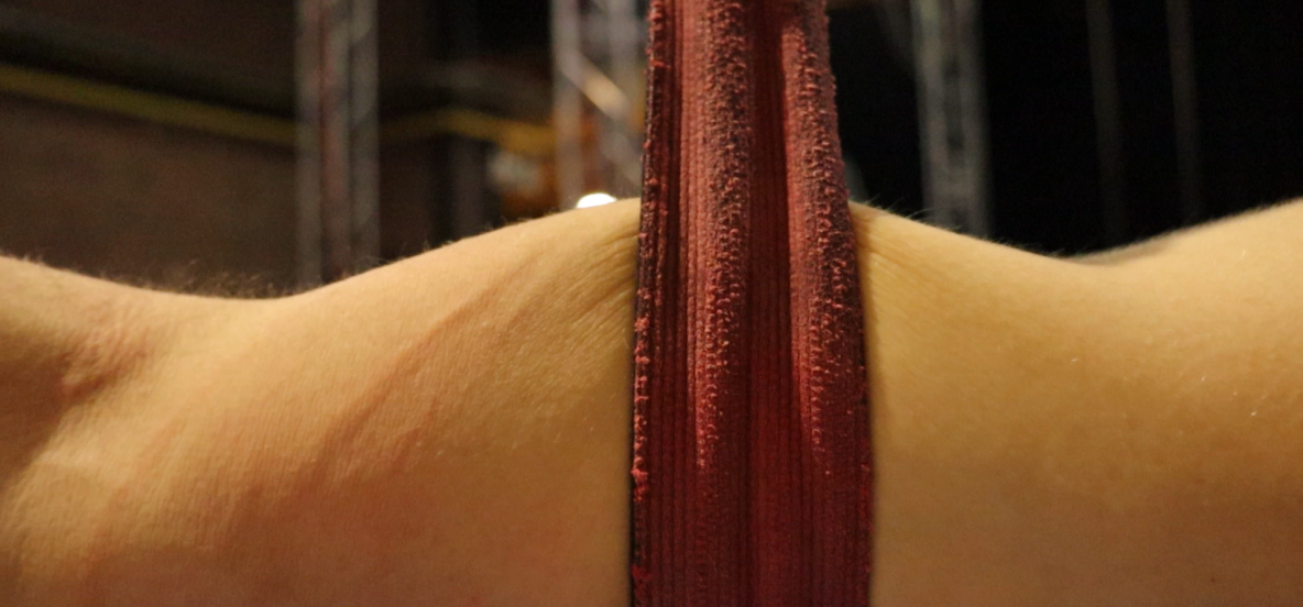 arm wordt gekneld door straps